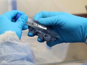 英国最大检测实验室暴发疫情，被指违反安全规定