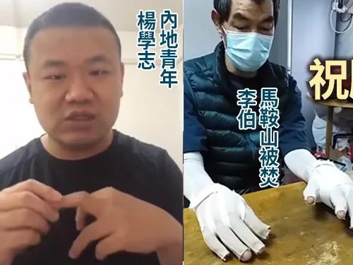 被暴徒焚身的李伯、被黑暴围殴的内地青年小杨，现在都怎么样了？