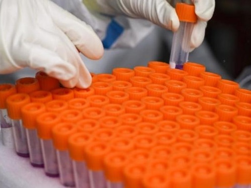 英国批准新冠病毒人体挑战试验，健康志愿者将暴露于病毒环境