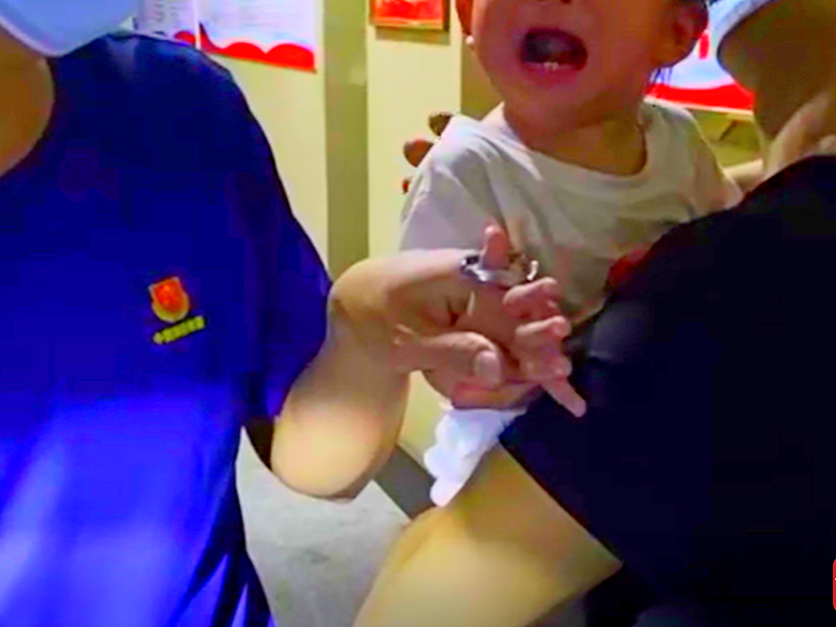 看着揪心！好奇小孩被铁环“咬手”