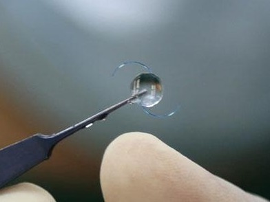 广东“团购”眼科人工晶状体，价格最高降幅达90%