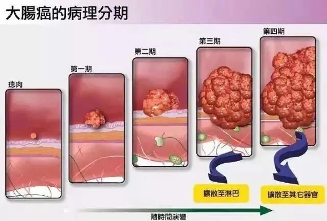 每小时3人得癌!最新深圳肿瘤榜头号杀手仍是它.这些习惯赶紧戒!