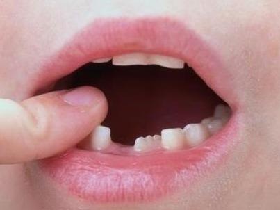 孩子换牙关键期要注意什么？家长要做对这几件事
