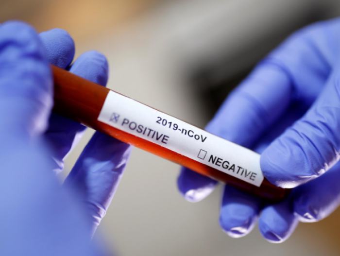 西班牙一名已接种辉瑞疫苗的妇女因新冠肺炎死亡