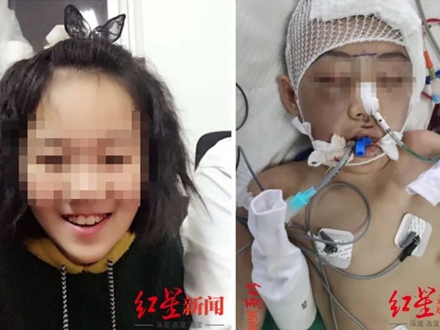 女童被继母打成植物人，一审宣判
