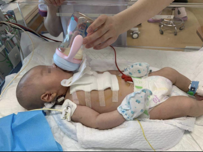 这种先天性心脏病死亡率极高，港大深圳医院成功为新生儿完成手术