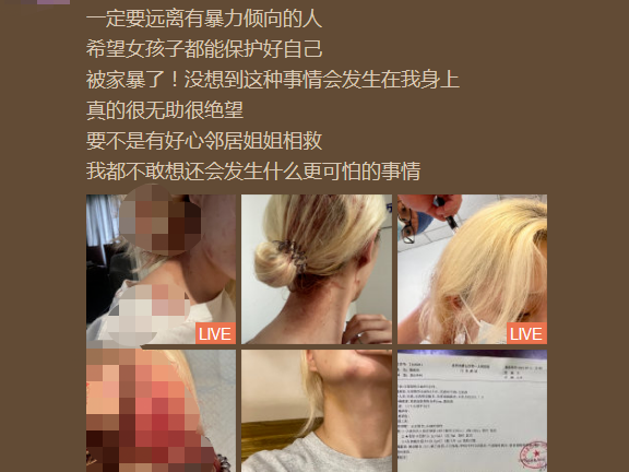 男子酒后电梯内殴打女友，警方回应！