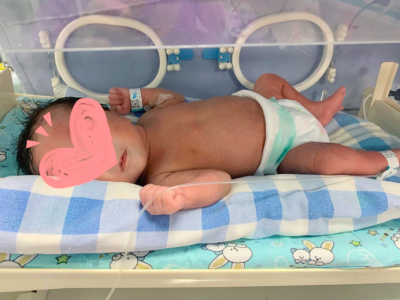 出生时8.9斤竟是患有严重胎儿水肿，龙岗妇幼多学科联合连续救治2例患儿