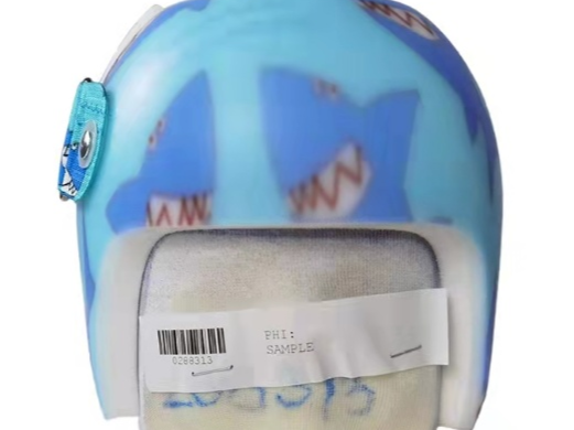 戴2.8万元头盔能让婴儿头型变好看？医生紧急提醒