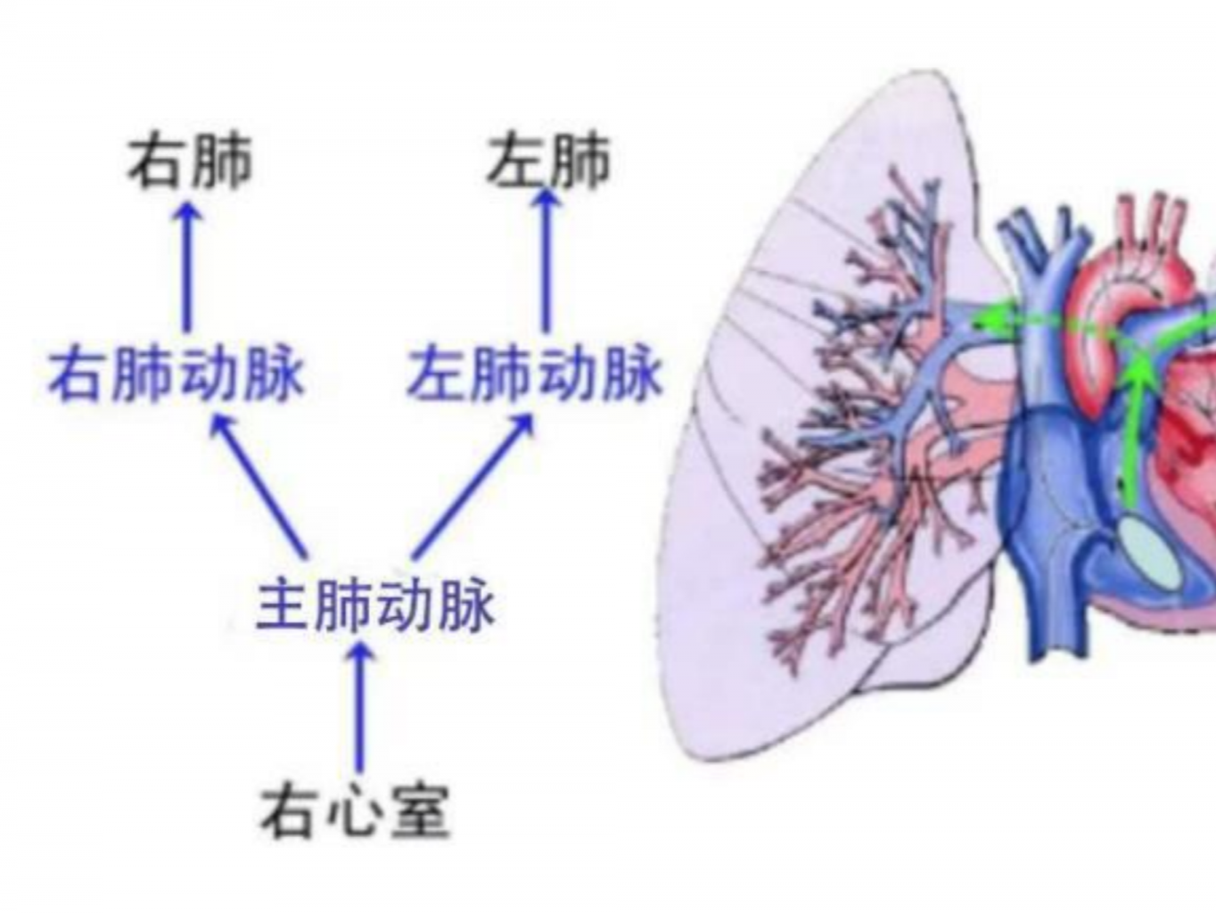 4个月宝宝右肺“停机”！这家医院巧建通道让右肺顺利“开机”