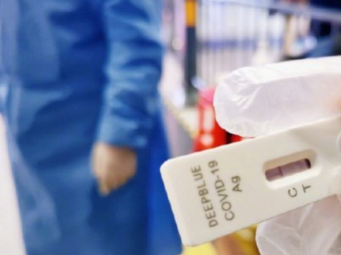 国家药监局已批准20个新冠病毒抗原检测试剂