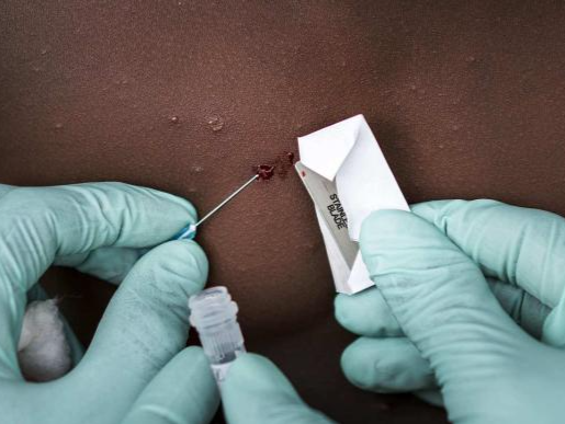 世卫组织：猴痘暴发暂不可能导致大流行，正研究病例激增原因