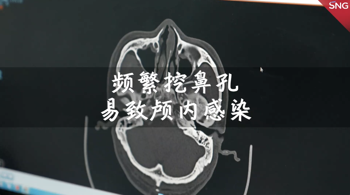 挖鼻孔和拔鼻毛有可能导致颅内感染