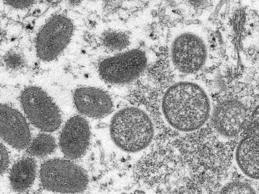 俄媒：巧合？至少4家美生物实验室在猴痘起源地运行