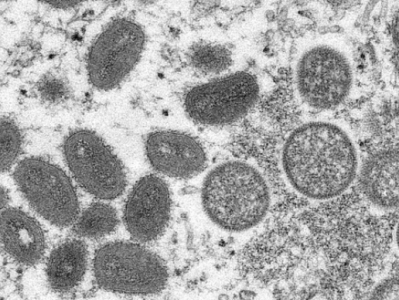 世卫组织：27个非猴痘流行国家已确诊780例，或进一步传播