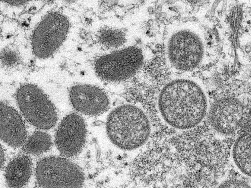 英国将猴痘列为法定应报告的传染病