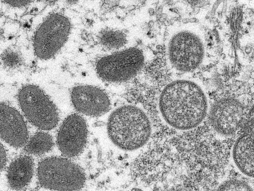 日本发现该国首例猴痘确诊病例