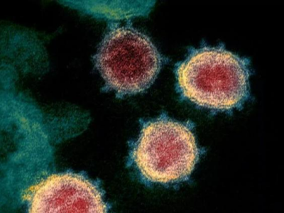 全球唯一一款新冠病毒感染预防药物首次获批准入中国大陆