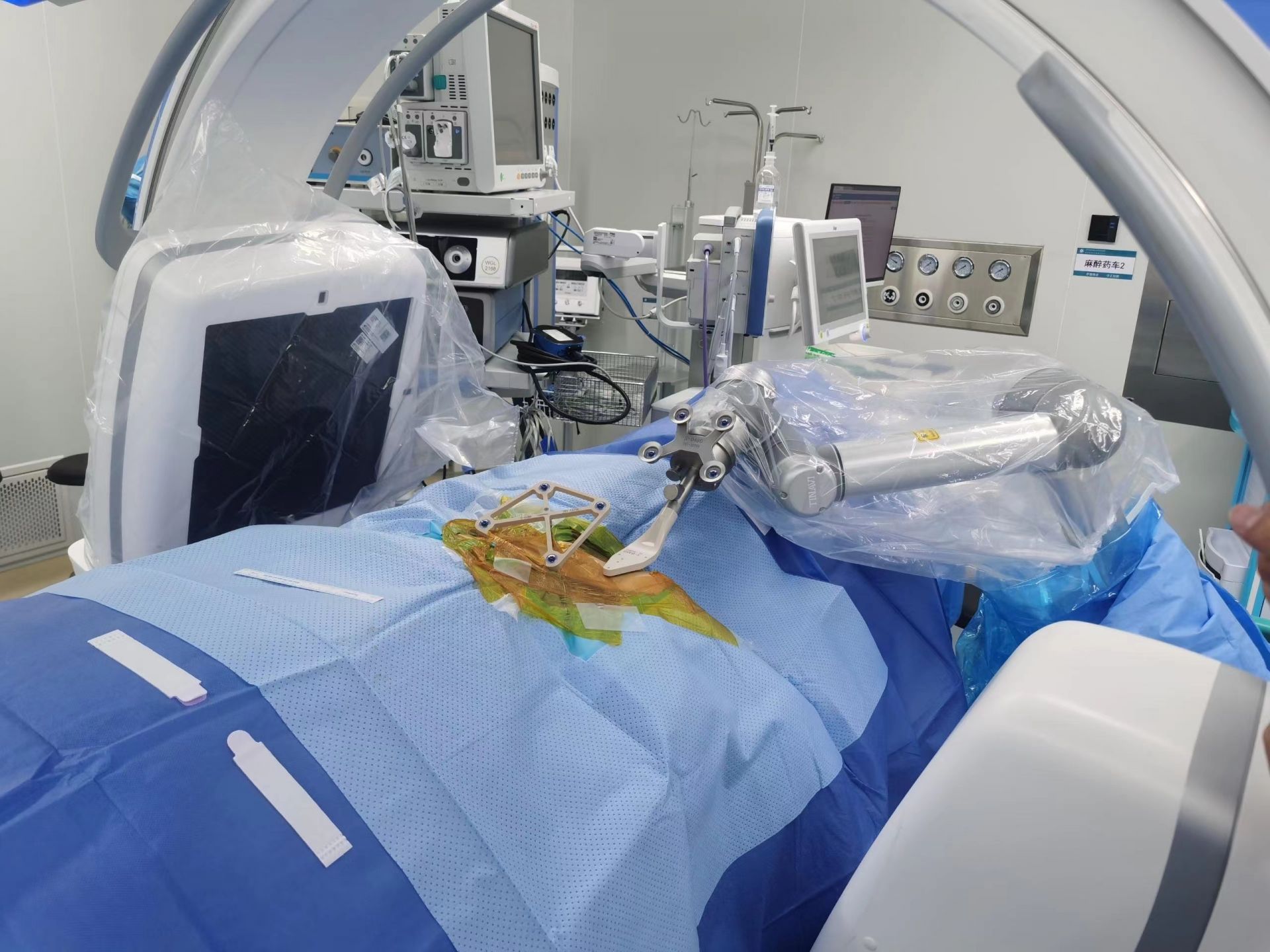 骨科机器人助力“挑战极限”，这家医院骨科手术更精准更微创