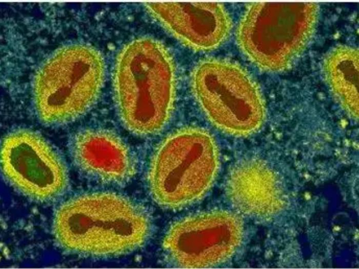 世卫组织：全球报告猴痘病例已超1.8万例