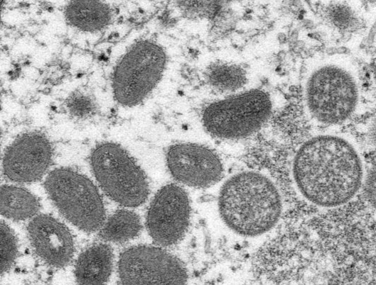 澳门将猴痘纳入传染病强制申报机制