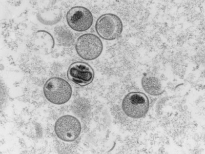 巴西猴痘确诊病例增至近千例