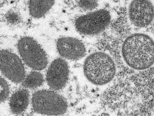 猴痘疫情已传播至美国49个州