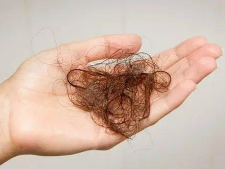 雄激素性脱发可以自愈吗？看看《中国男性秃发调研洞察报告》怎么说