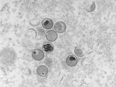 世卫组织公布猴痘病毒分支新命名：罗马数字和小写英文字母组成