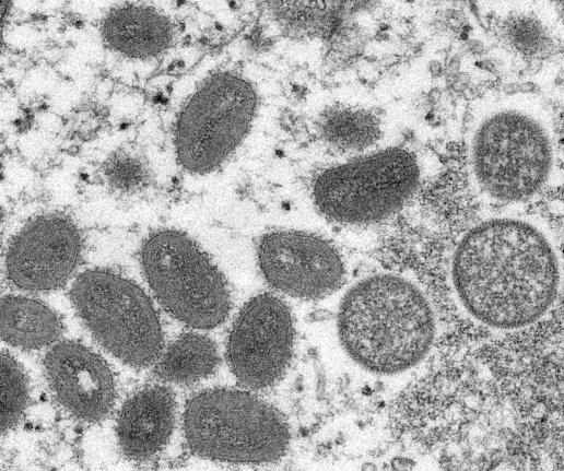 中疾控：猴痘已在全球70多个国家和地区传播 我国尚未发现病例