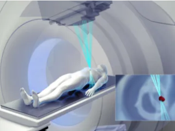 中国专利奖丨奥沃：伽玛刀外观专利，让癌症患者走进“太空舱”