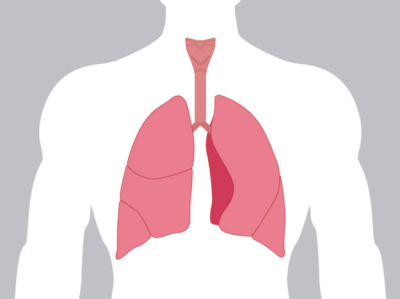 两部门：依托应急总医院组建国家尘肺病诊疗中心 建立尘肺病防治帮扶机制