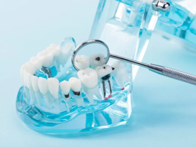 牙周疾病困扰老年人 专家：应及时就医防止加重