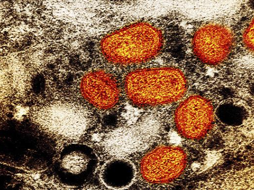 英国宣布出现新型猴痘病毒毒株 患者曾去过西非