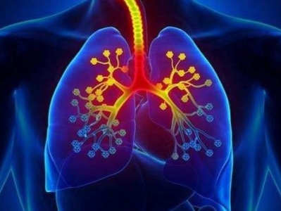 空气污染引发非吸烟者肺癌的机制确定