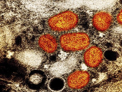 拜登政府签订1980万美元合同，以扩大猴痘的应对措施