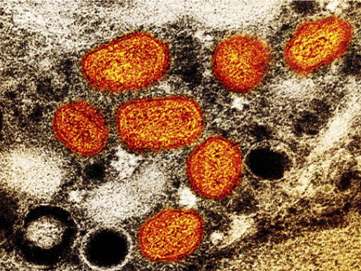 世卫组织：全球累计猴痘确诊病例超5万例，死亡16例