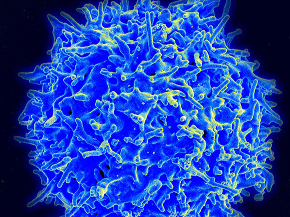 研究显示：T细胞免疫疗法能缓解自体免疫疾病，无药改善症状达17个月