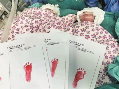 三宝挤进“两房” 深圳高龄产妇平安产下三胞胎