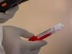 聚光灯｜防疫最大的敌人是恐惧与偏见
