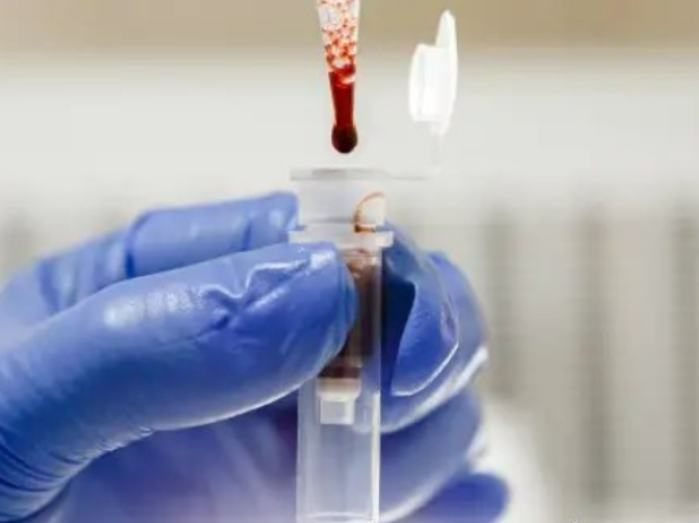 英国“人造红细胞”首次用于人体试验