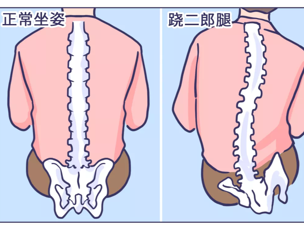 戒不掉的”二郎腿“，危害有多大？