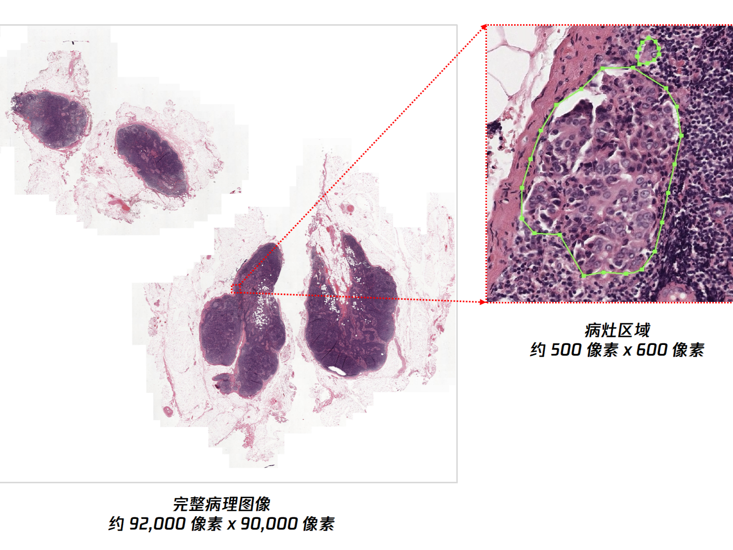 帮助医生“阅片”，腾讯将游戏AI用于疾病诊断