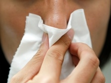为什么冬季鼻炎易发作？如何对症治疗？专家解答