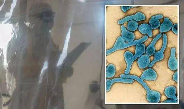 患者症状似乎指向“某种病毒性出血热”