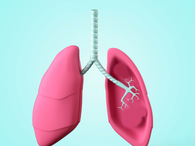 迄今最大最全人类肺细胞图谱公布