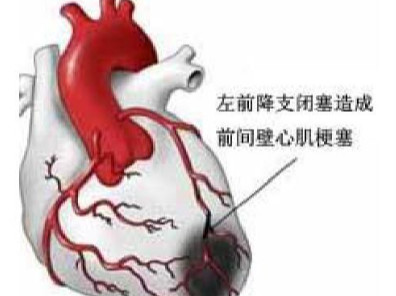 命悬一线！深圳市人民医院成功为八旬患者“修补”心脏