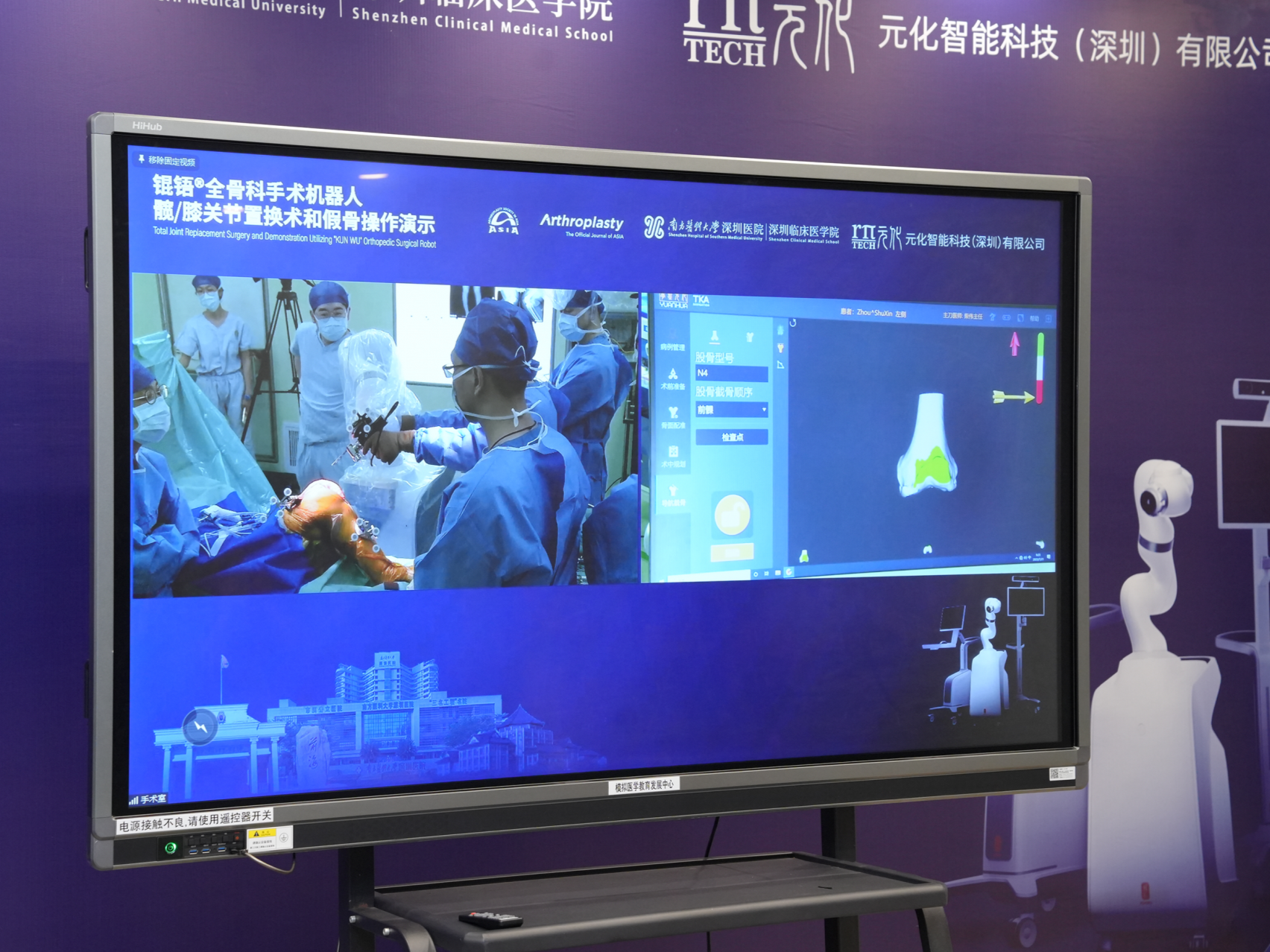 直播首秀！ “深圳智造”骨科机器人助力完成83岁患者全膝关节置换术