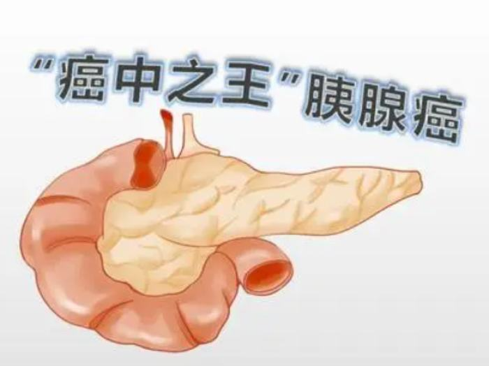 一发现大部分是中晚期，这种病为什么这么可怕？