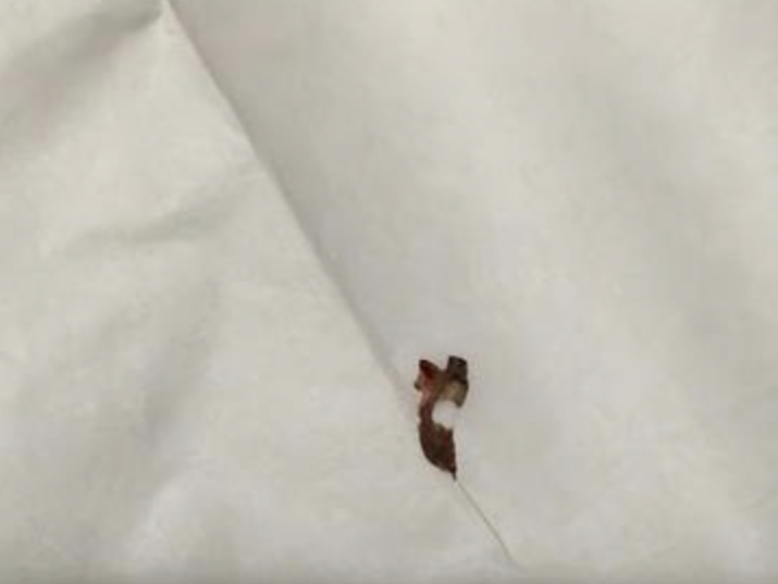 港媒关注境外床虱问题，官方：无迹象显示在香港社区扩散